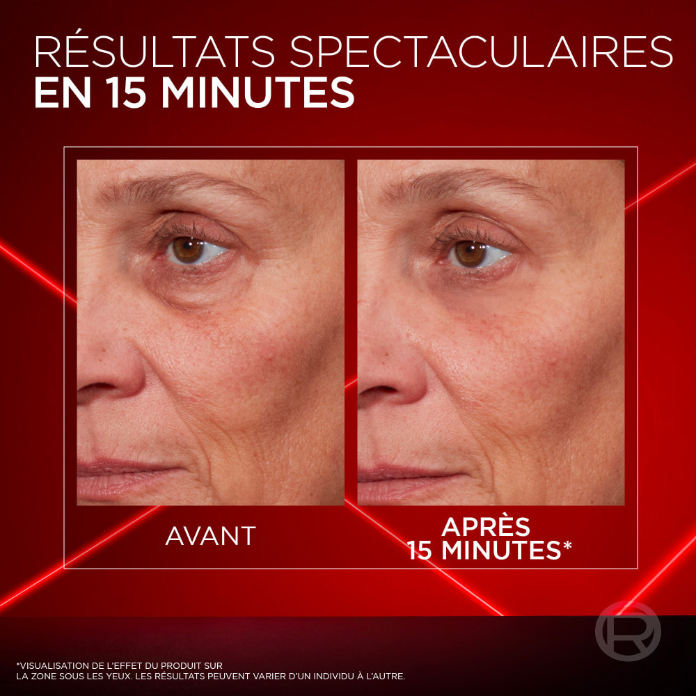 L'Oréal Paris Revitalift Laser Correcteur de poches instantané 15ml
