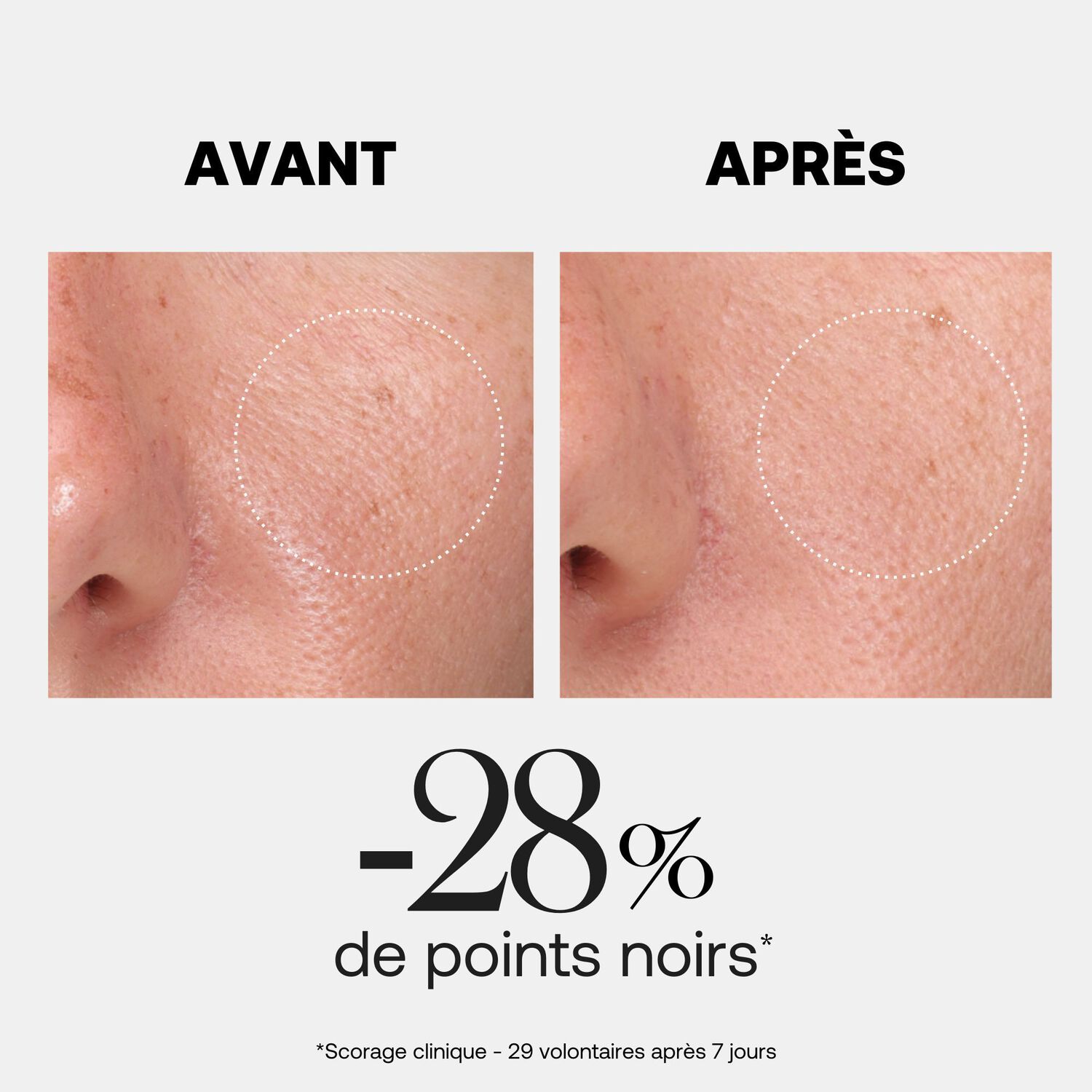 Hyalurx - Gel-En-Cellulose Exfoliant 50ml