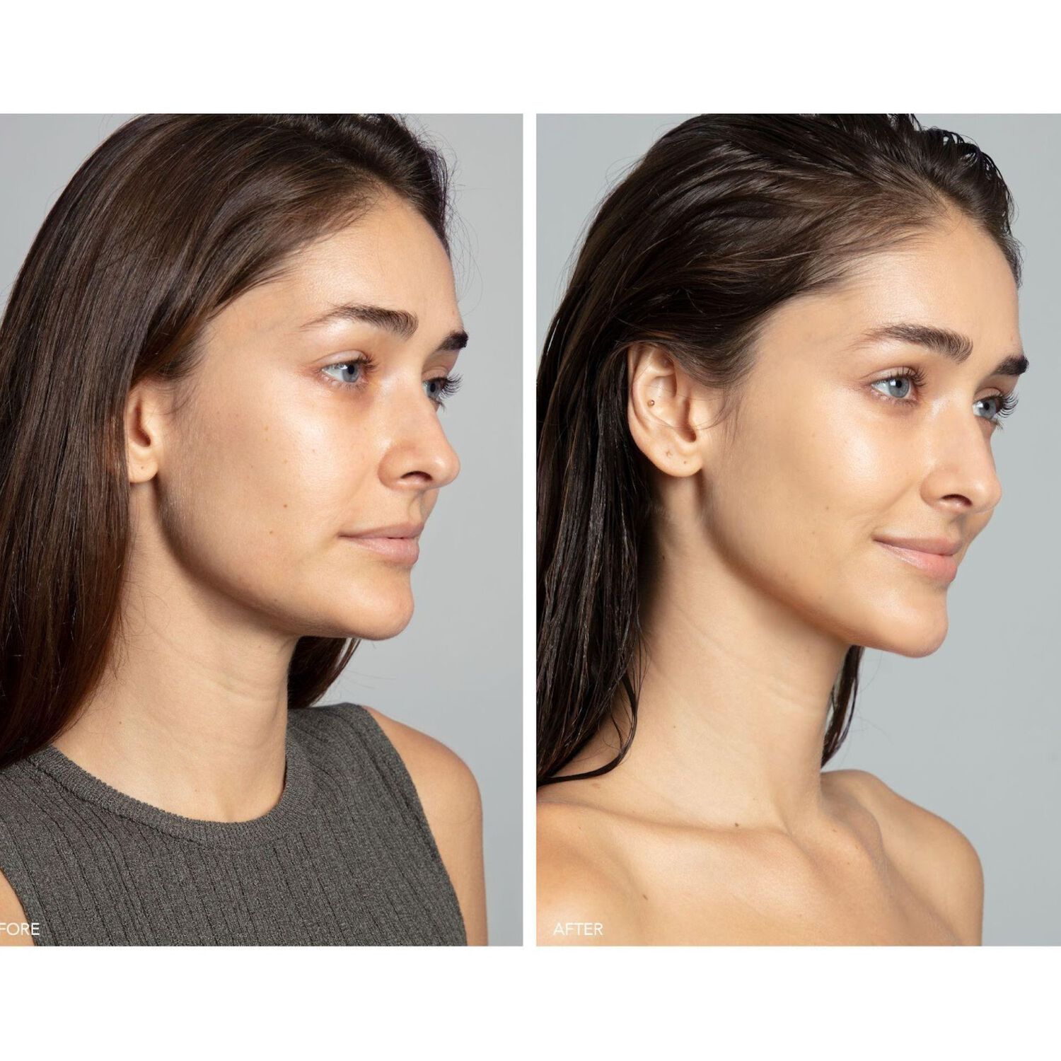 BEAR™ 2 - Appareil Visage Tonifiant Microcourants