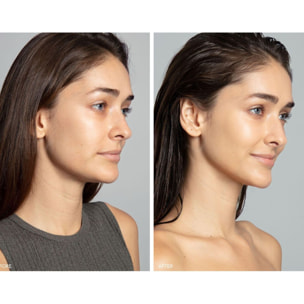 BEAR™ 2 - Appareil Visage Tonifiant Microcourants