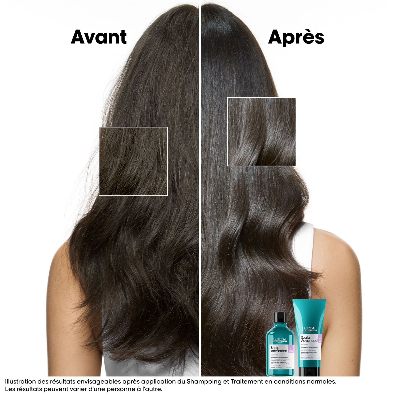 Serie Expert Scalp Advanced - Recharge Shampoing niacinamide dermo-régulateur apaisant - cuirs chevelus sensibles 300 ml