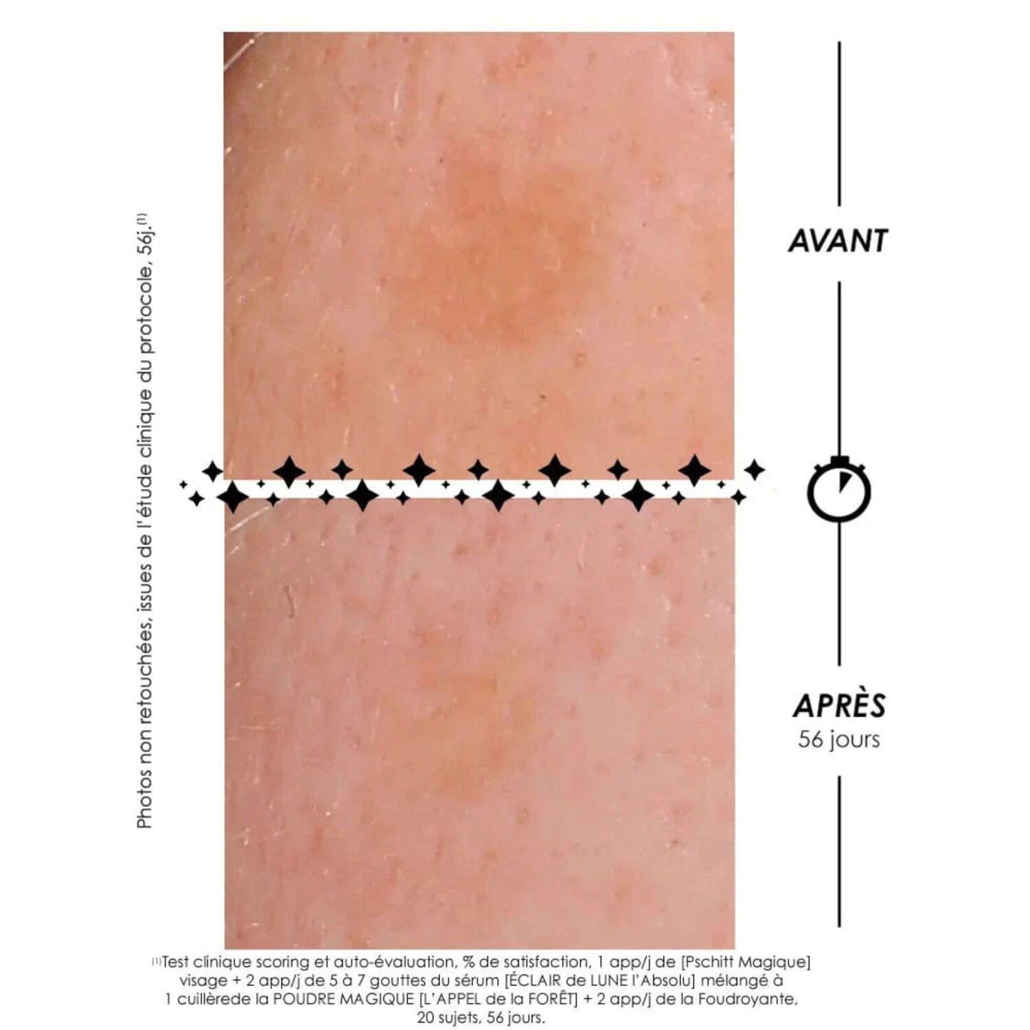 Eclair de Lune La Foudroyante  - Coffret Crème Lactée Anti-Tâches 30ml + Stick Solaire Invisible 15g