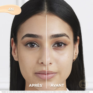 L'Oréal Paris Sérum Anti-Cernes Accord Parfait 4N 11ml