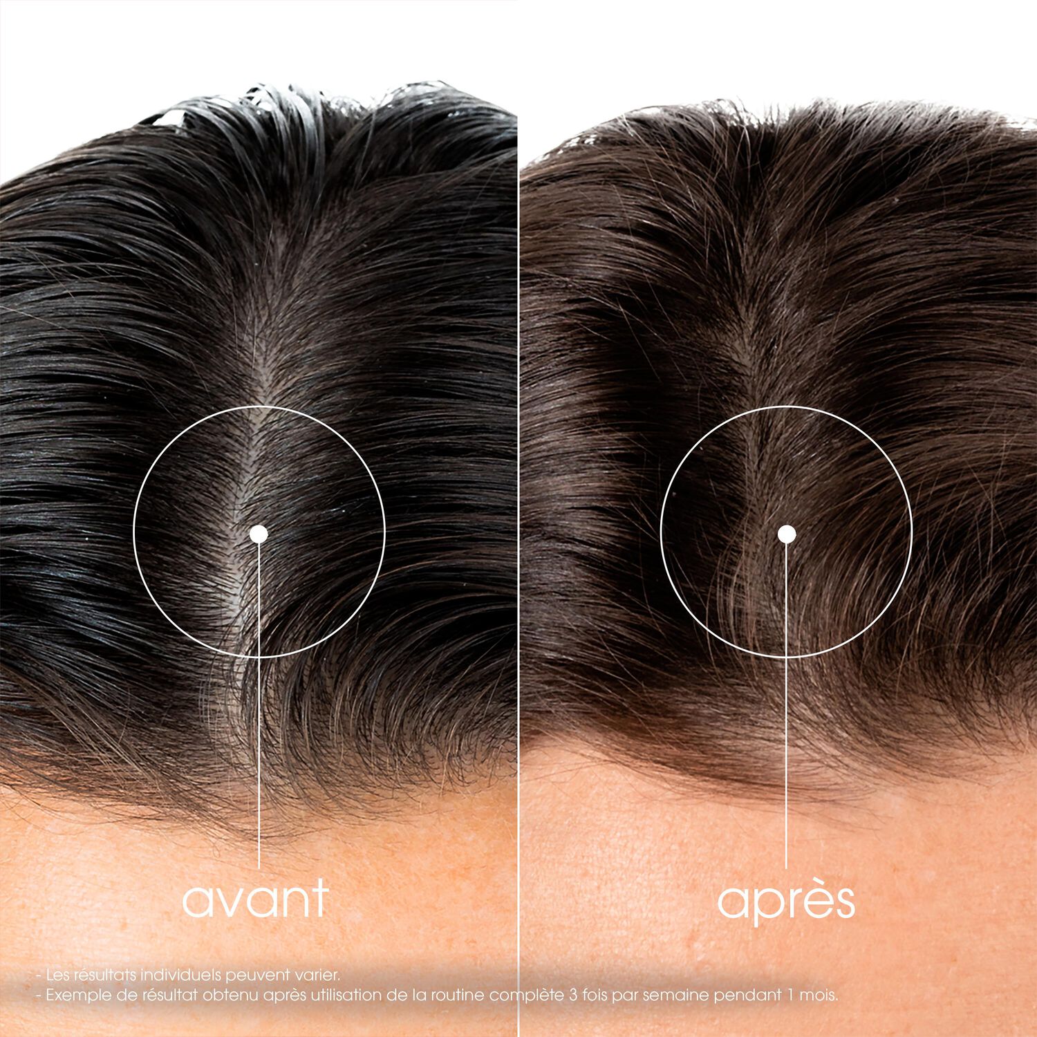 Antichute - Shampoing fortifiant et stimulant