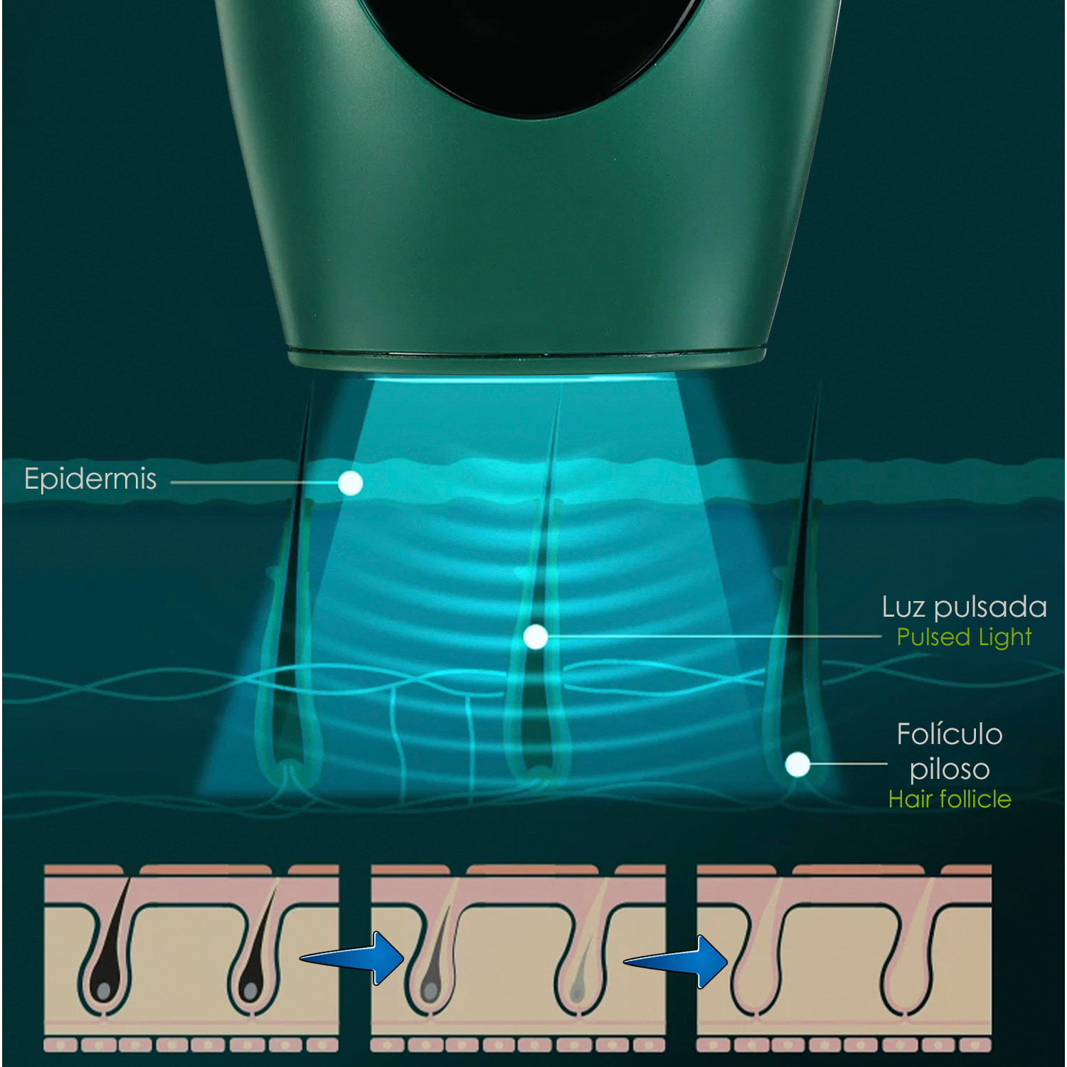 Epilatore a luce pulsata IPL. 8 livelli, 900.000 scatti flash.