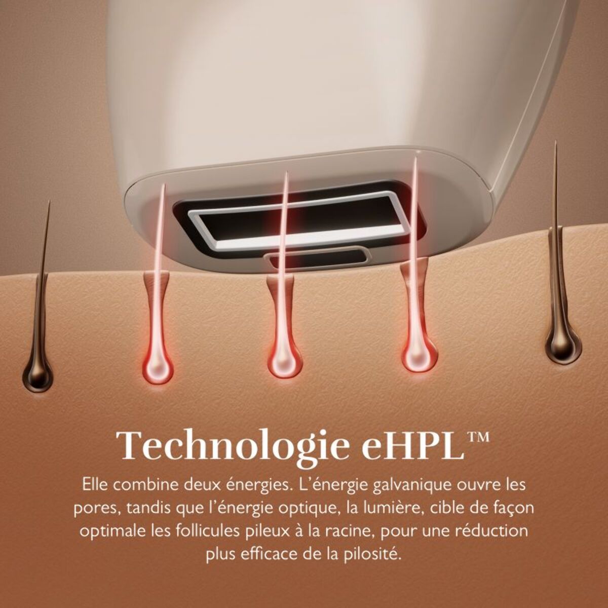 Epilateur lumière pulsée SILK'N Infinity fast