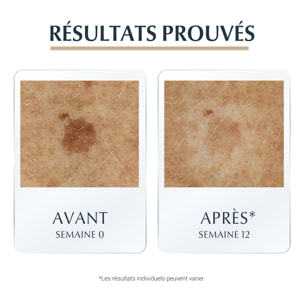 Hyaluron Filler +Elasticity - Sérum Anti-Age, Tâches Brunes & Rides 30 ml