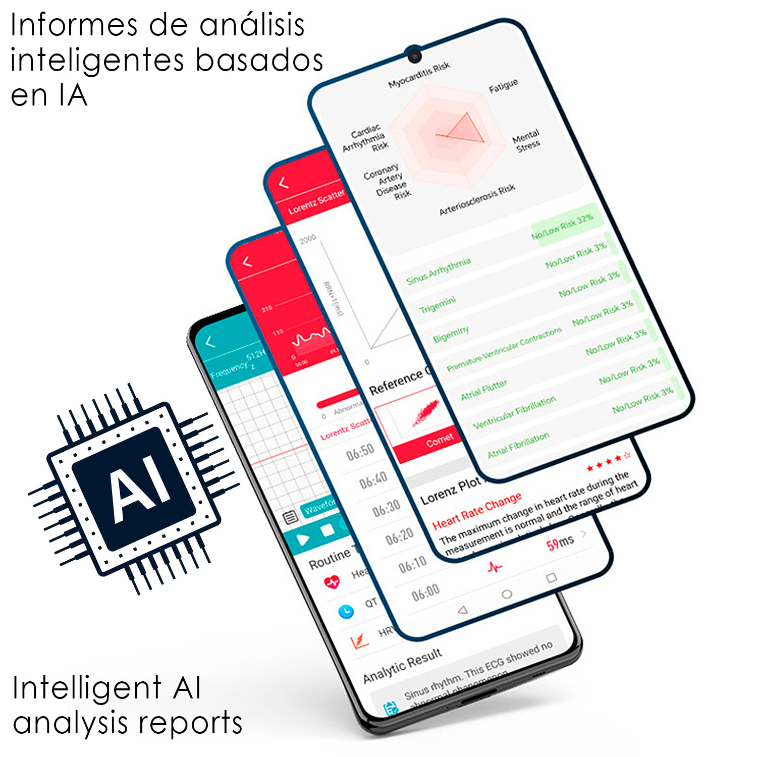 Smartwatch JA03. Llamadas Bluetooth con funciones avanzadas de salud: ECG, lípidos, glucosa, oxígeno en sangre, tensión arterial, composición sanguínea y composición corporal.