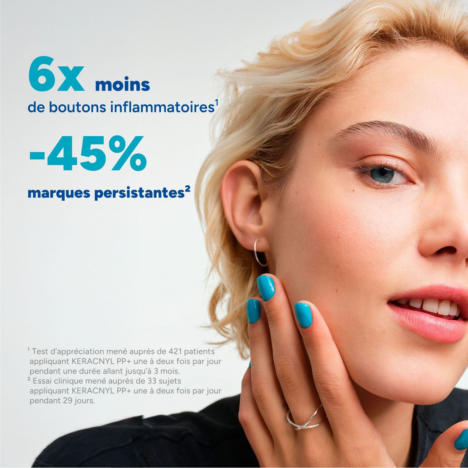 Keracnyl Pp+ - Soin Anti-Imperfections et Anti-Récurrence 30 ml