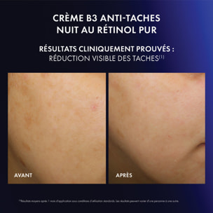 Liftactiv - Crème de Nuit Correctrice de Teint Vitamine B3 50 ml