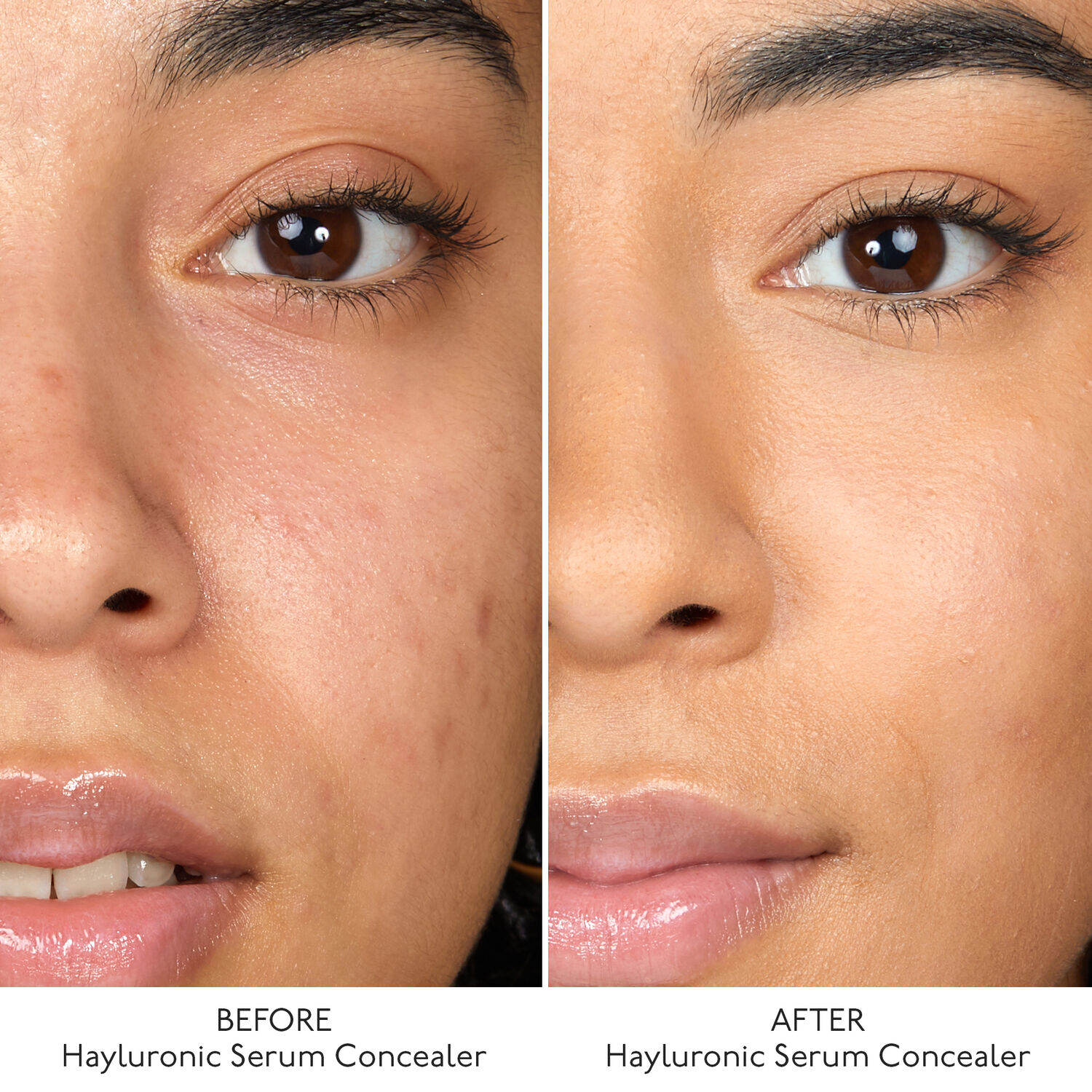 Hyaluronic Serum Concealer - Anti-Cernes Ultra Soin