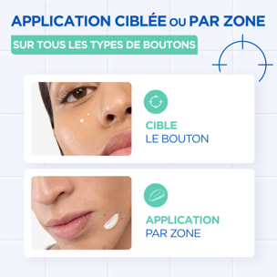 Mixa Pâte Concentrée Anti-Bouton, Pâte Anti-Boutons Ciblée à l'Acide Salicylique et à la Niacinamide- Action rapide sur tous les