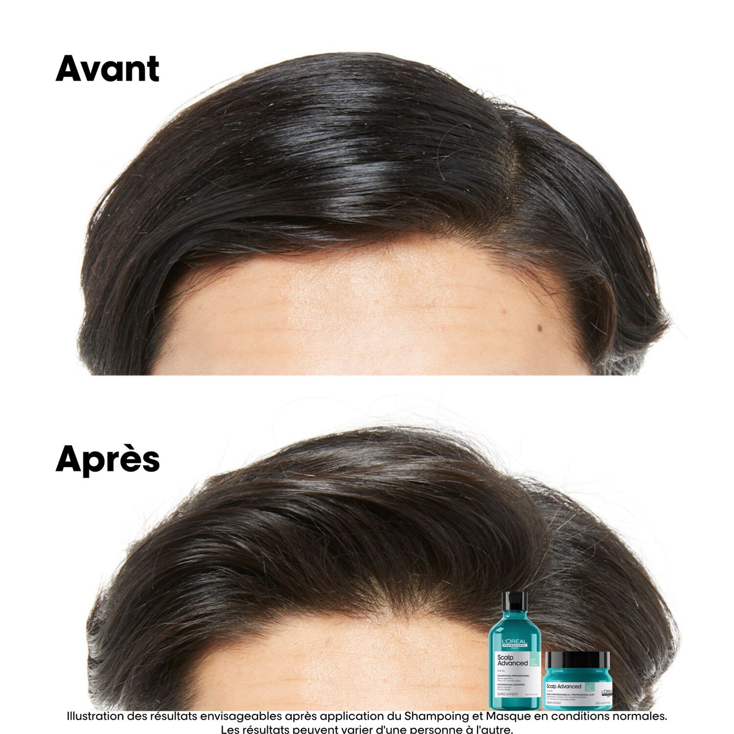 Scalp Advanced - Argile 2-en-1 Purifiante Anti-Gras 250 ml