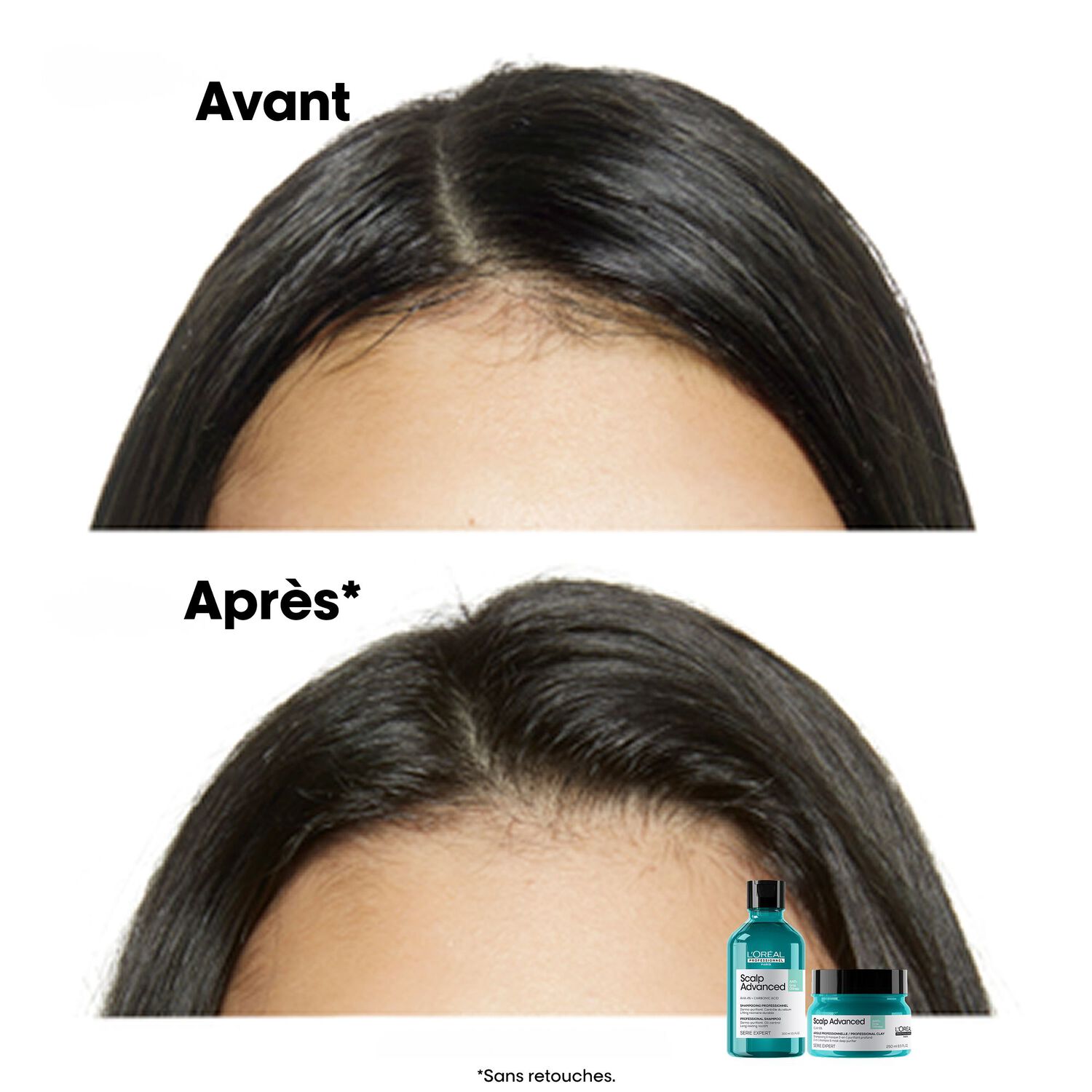 Serie Expert Scalp Advanced - Shampooing Dermo-Purifiant - Cuirs Chevelus Gras 300 ml