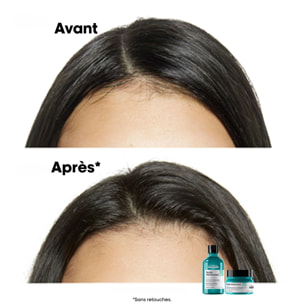 Serie Expert Scalp Advanced - Shampooing Dermo-Purifiant - Cuirs Chevelus Gras 300 ml