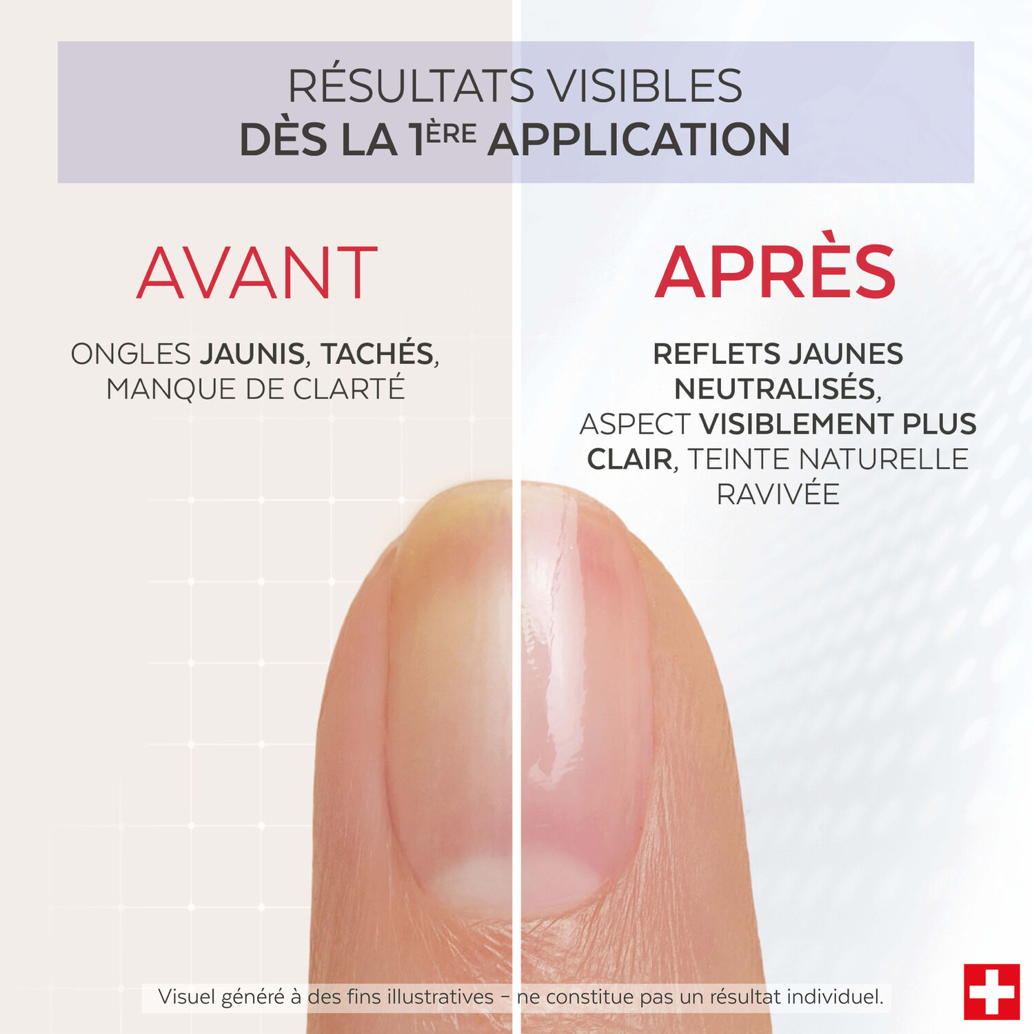 Nail Corrector - Vernis Déjaunissant Citron 8 ml