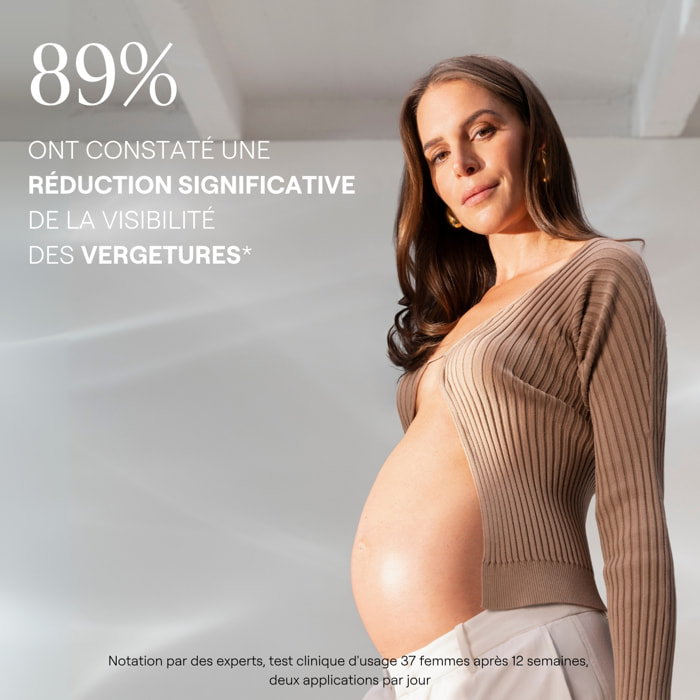 WELEDA - Duo Baume de Massage Vergetures - 2 x 150 ml