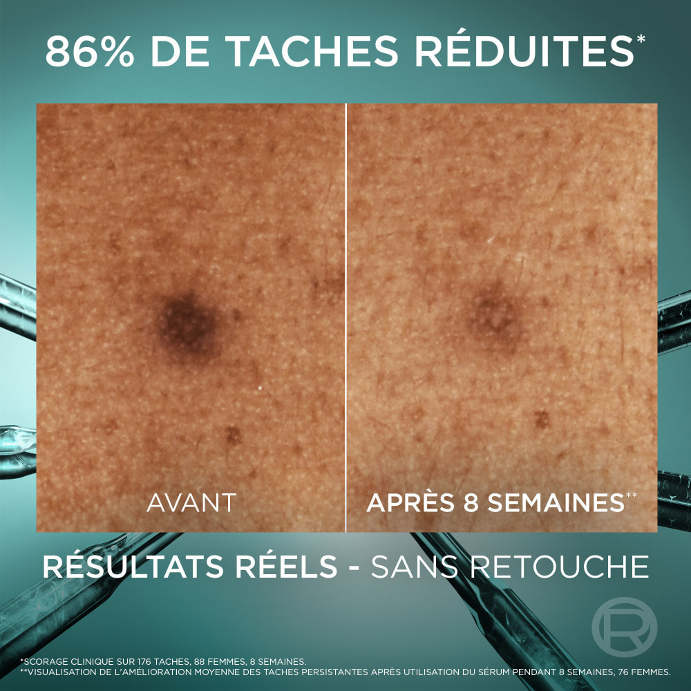 L'Oréal Paris Routine Visage Anti-Tache Sérum Niacinamide + Stick Anti-UV SPF50+