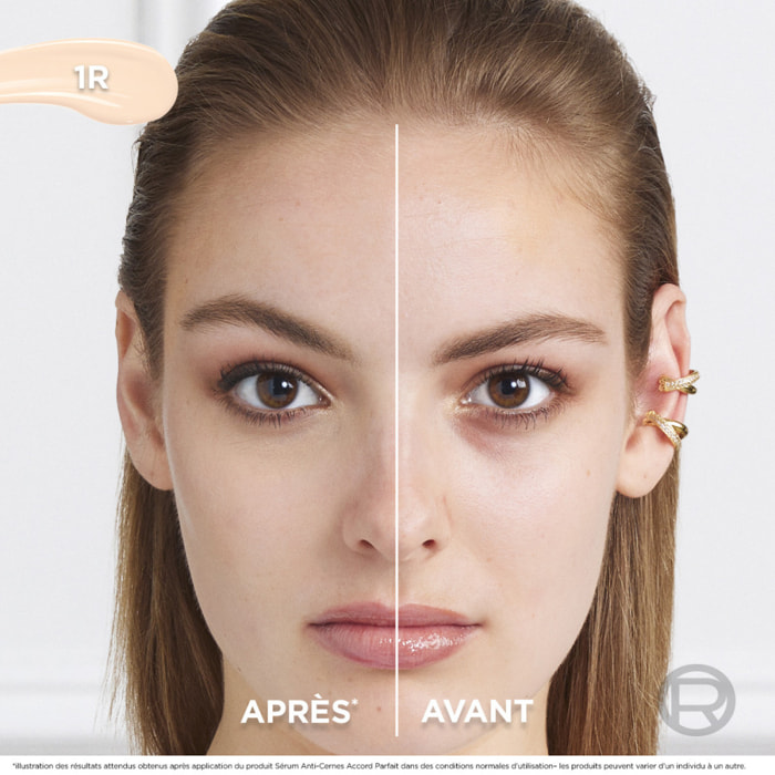 L'Oréal Paris Sérum Anti-Cernes Accord Parfait 1R 11ml