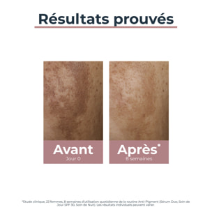 Anti-Pigment - Sérum Duo Anti-Tâches 30 ml