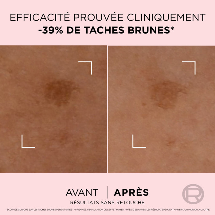 L'Oréal Paris Age Perfect Golden Age Sérum Correcteur Taches Brunes 30ml