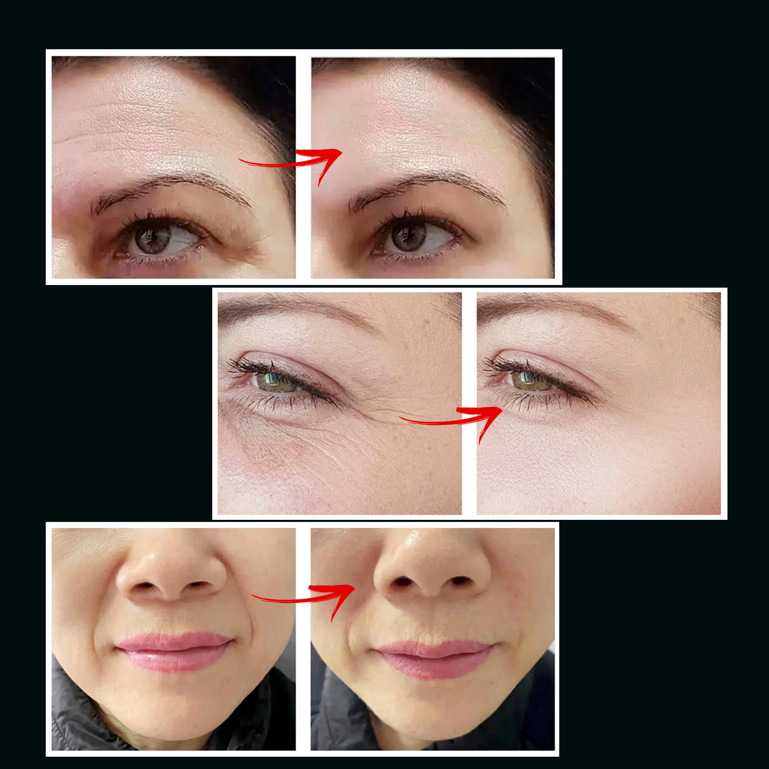 Dispositivo de belleza con RF,VR, EMS y luces LED.