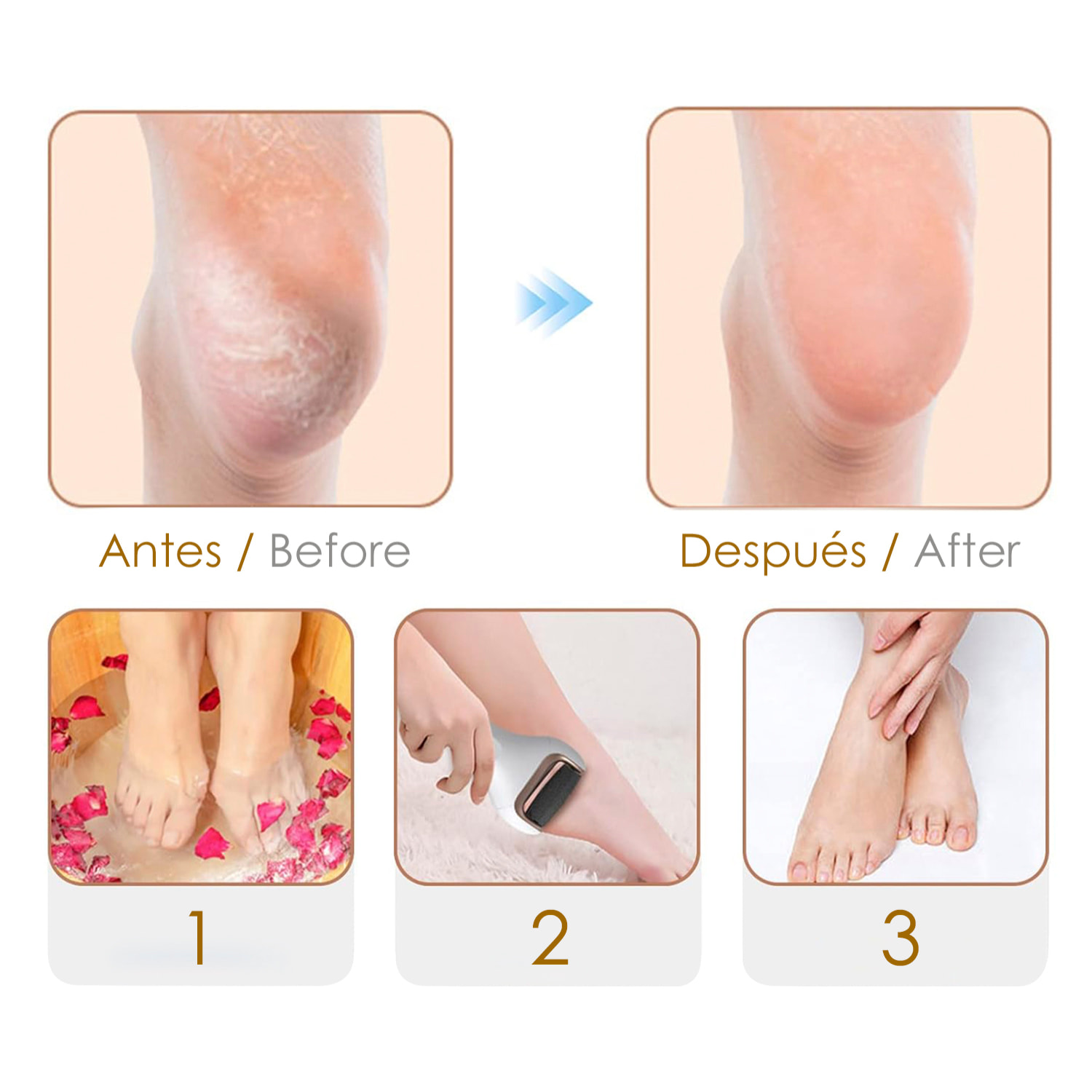 Lima elettronica per piedi, pedicure avanzata.