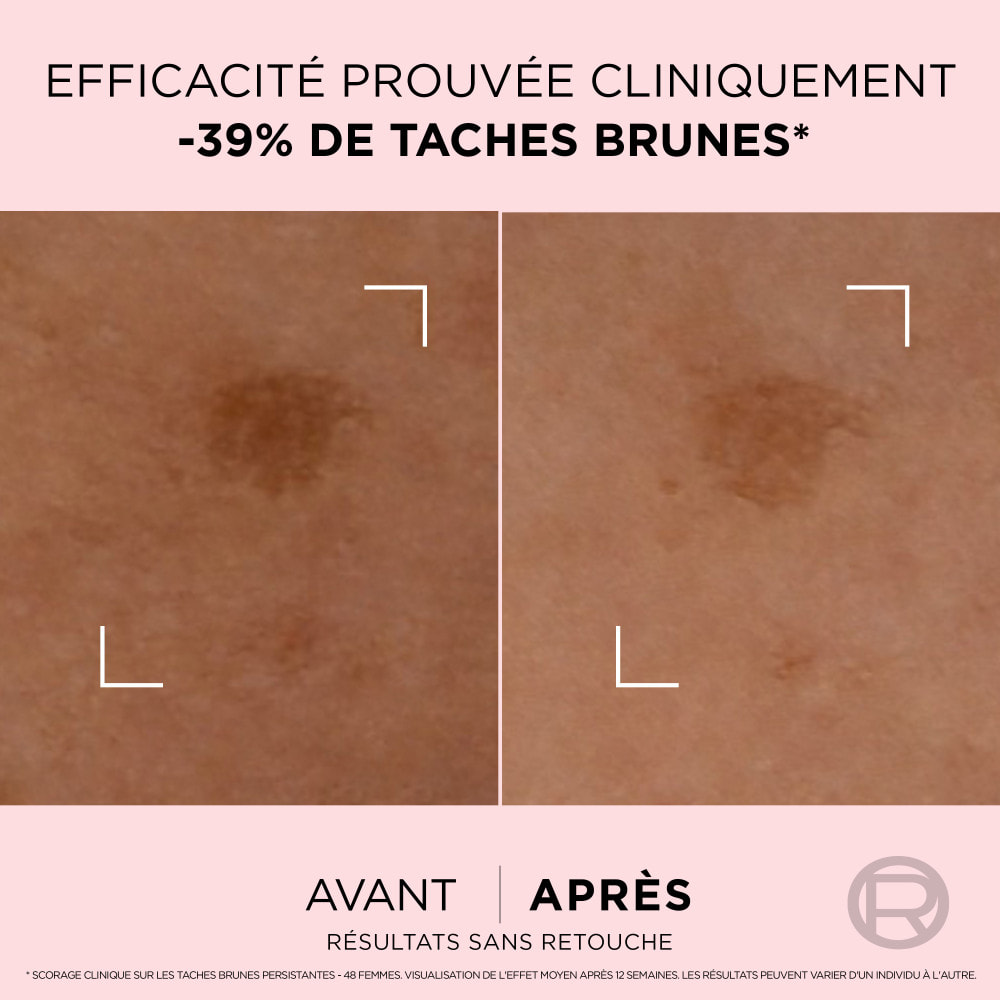 L'Oréal Paris Age Perfect Golden Age Sérum Correcteur Taches Brunes 30ml