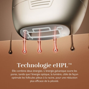 Epilateur lumière pulsée SILK'N 7 gold