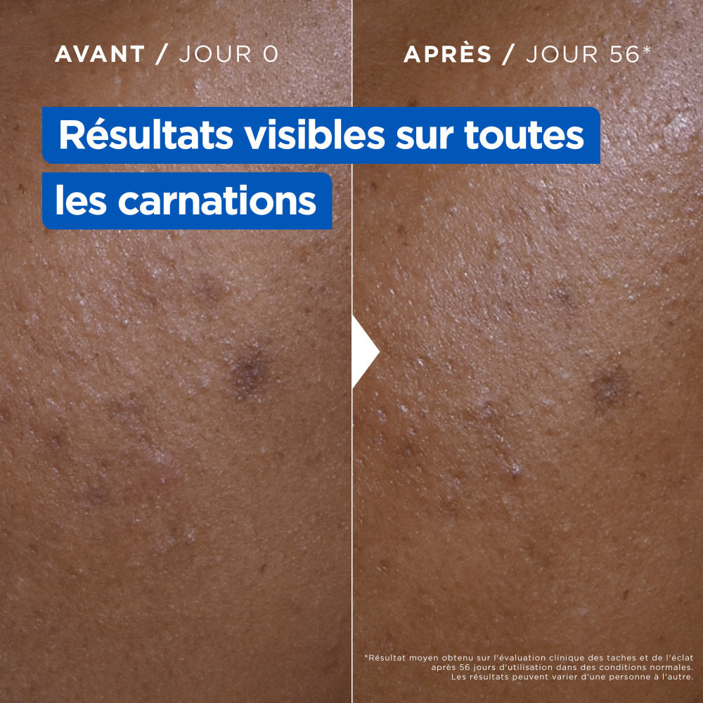 Mixa Crème Niacinamide Correction Éclat 400ml