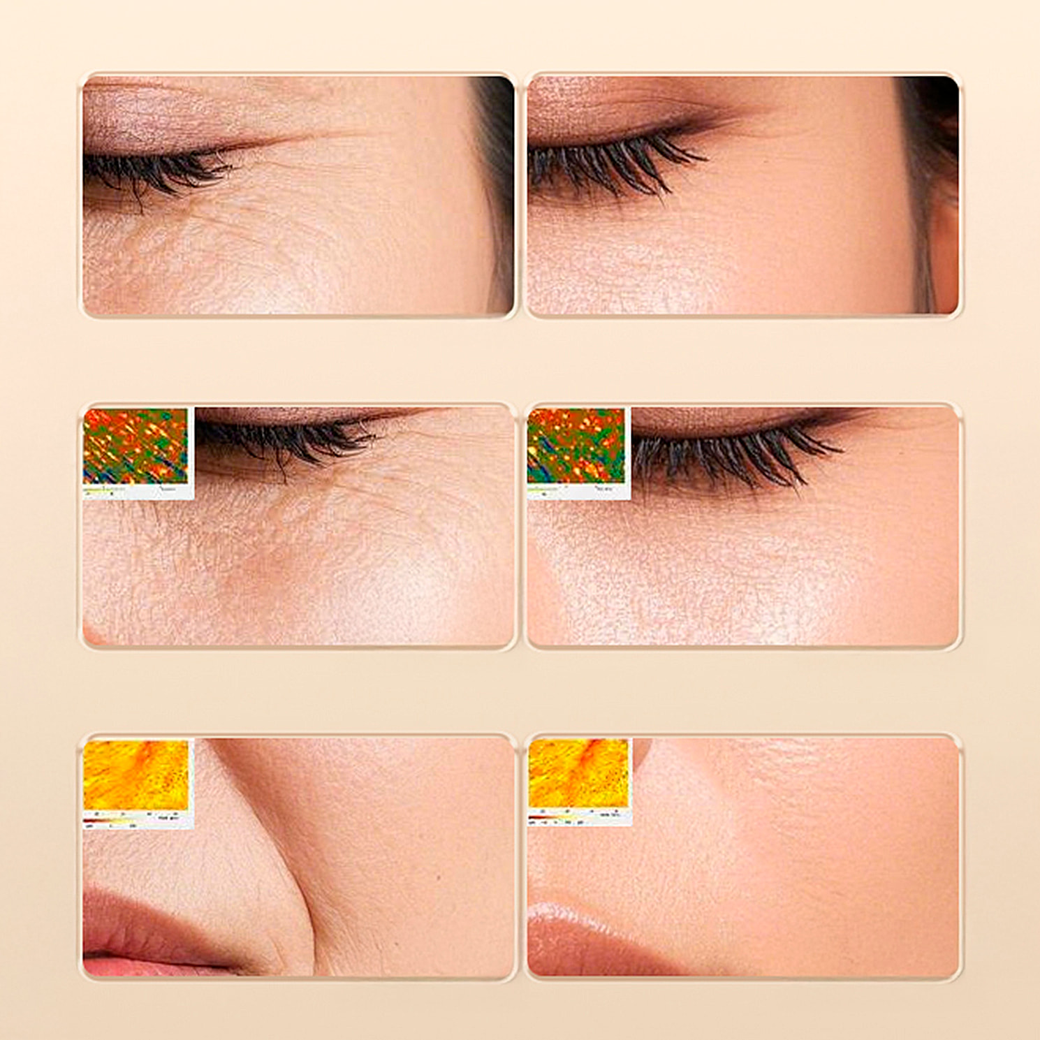 Instrumento de belleza de colágeno con 2 modos de uso y 3 intensidades.