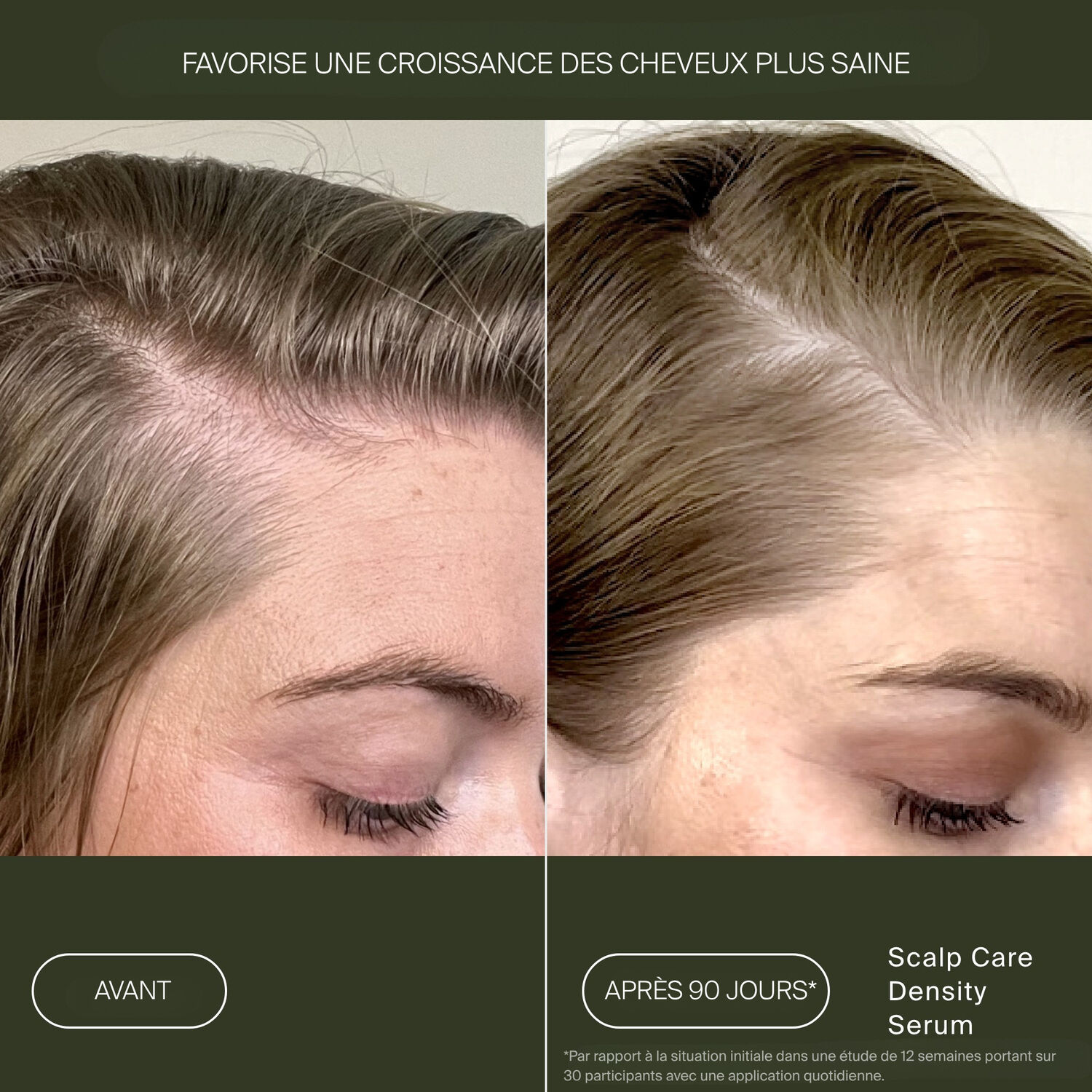 Scalp Care - Sérum Densité Cuir Chevelu 50 ml