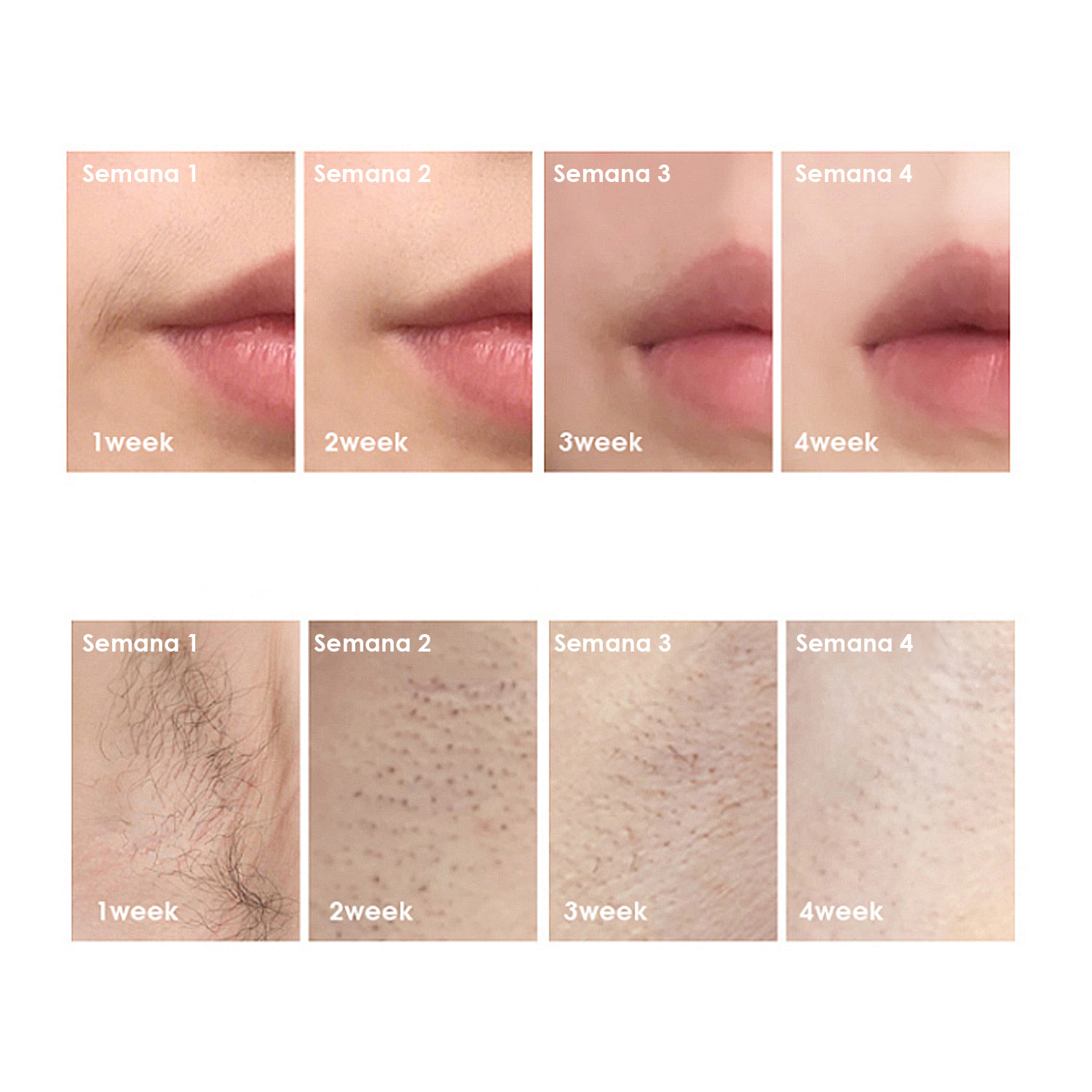 TS6 Depilatore IPL a luce pulsata con schermo display e protezione blackout.