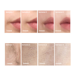 TS6 Depilatore IPL a luce pulsata con schermo display e protezione blackout.