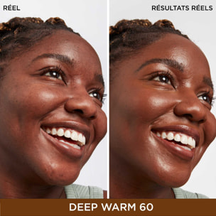 Bye Bye Dark Spots Concealer  - Correcteur de Teint + Sérum 9g