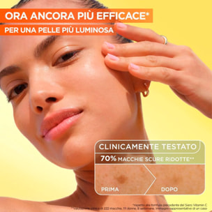 Siero Viso Anti-Macchie SkinActive Vitamina C+ Illuminante Uniformante Antiossidante con Acido Salicilico Niacinamide e Melasyl - Flacone da 30ml