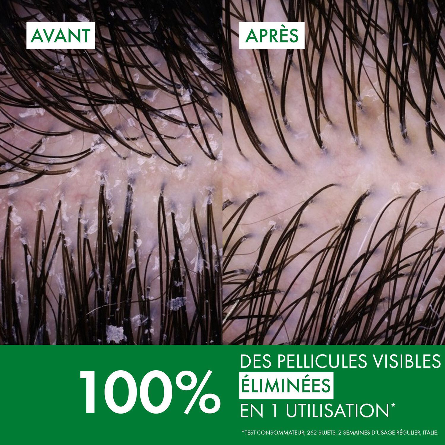 Dercos Technique  - Shampooing Traitant Anti-Pelliculaire