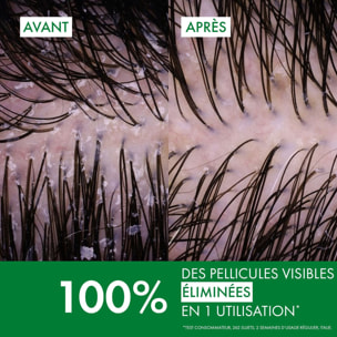 Dercos Technique  - Shampooing Traitant Anti-Pelliculaire