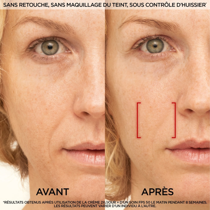 L'Oréal Paris Laser Recharge Soin Anti-Âge Jour à l'Acide Hyaluronique, Pro-Rétinol et Vitamine C 50ml
