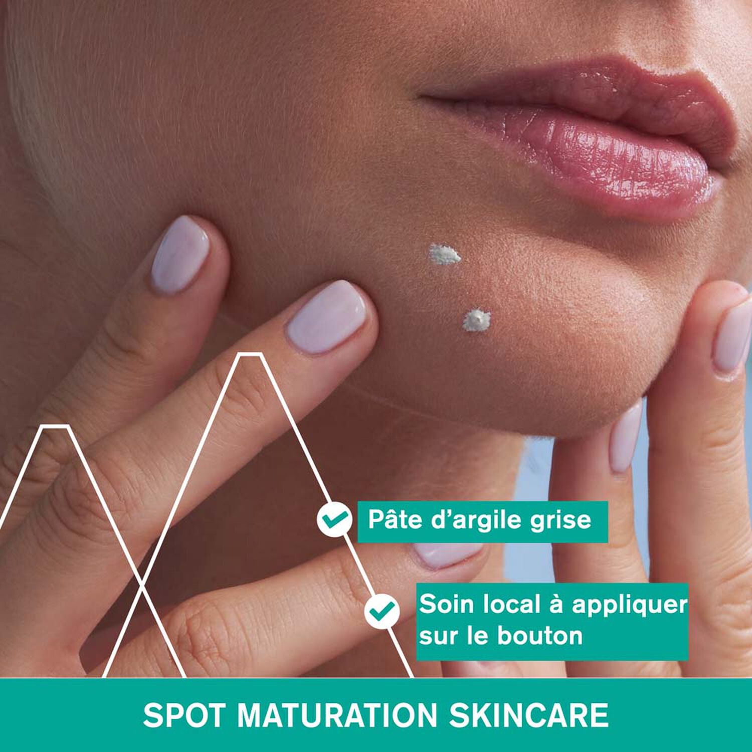 Hyséac - Pâte SOS 15 ml