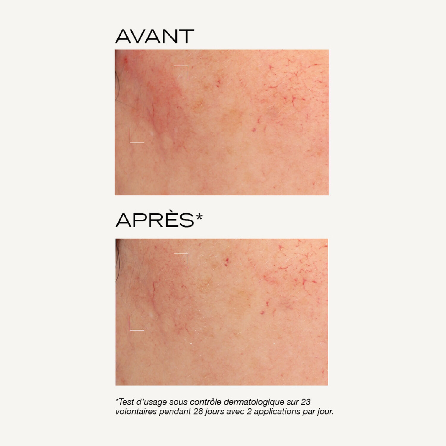 Nue - Masque Peeling Intense 50ml