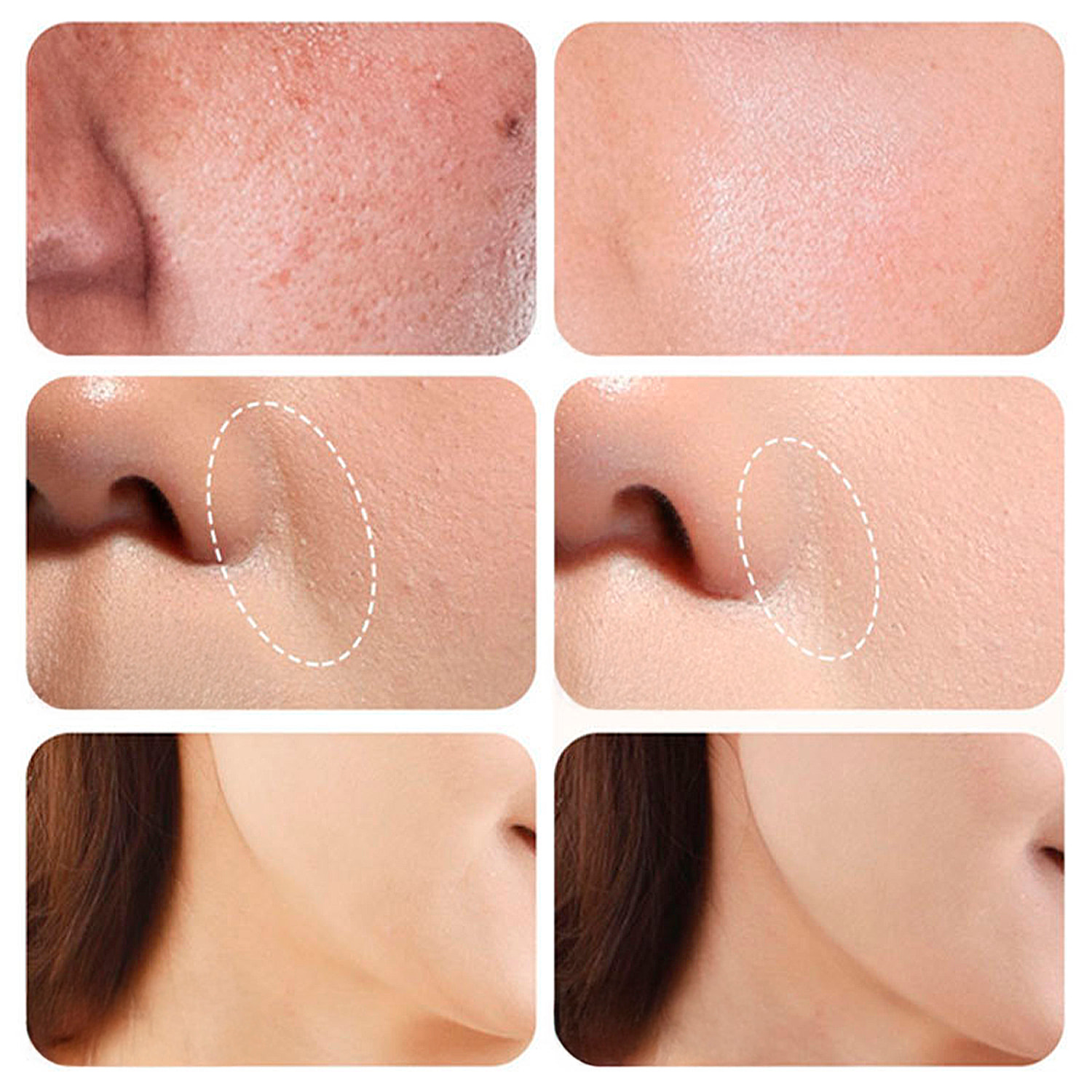 Strumento di bellezza RF multieffetto con 4 modalità d'uso.