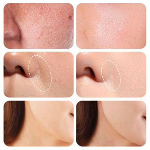 Strumento di bellezza RF multieffetto con 4 modalità d'uso.