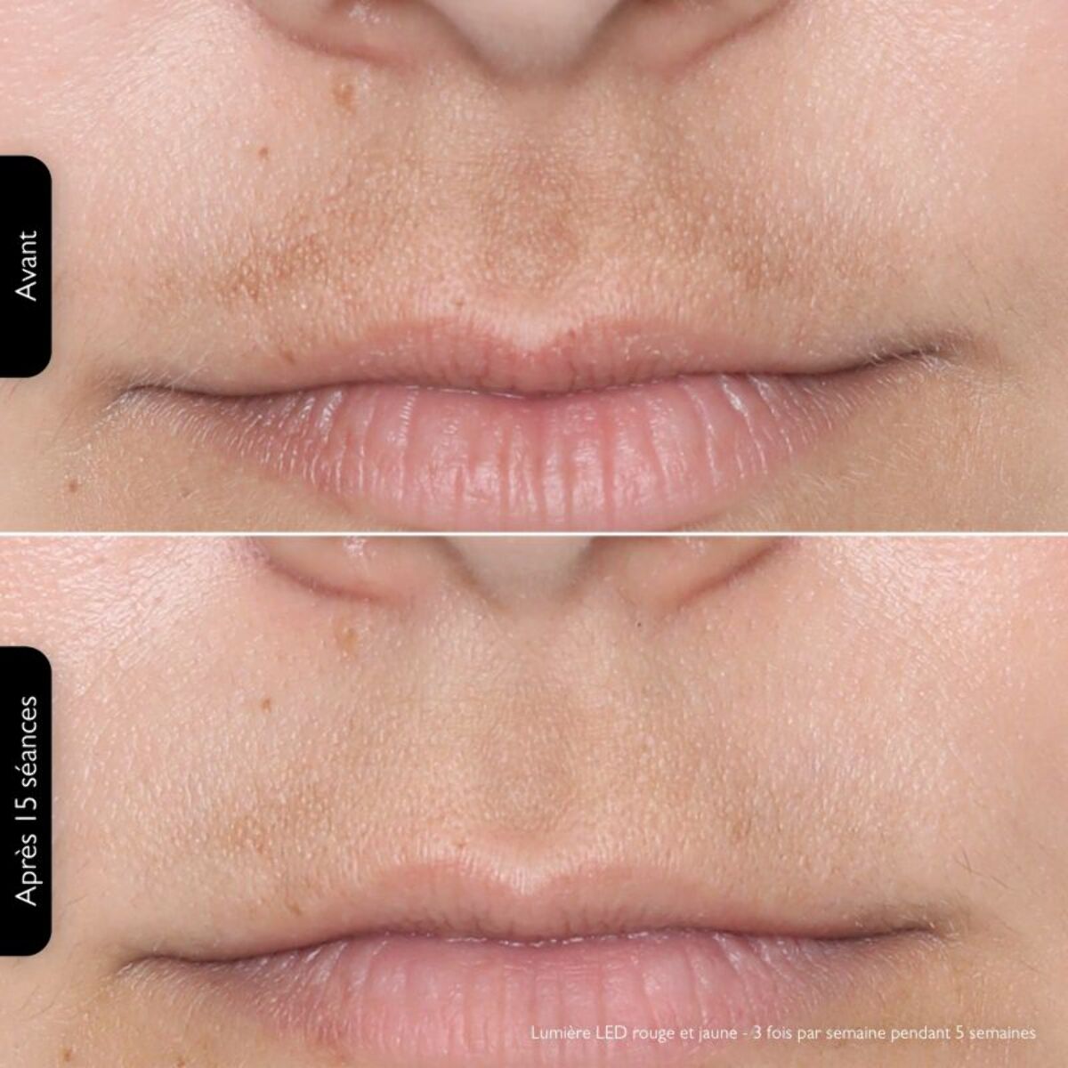 Masque LED SILK'N LED Face Mask 100 FLM100