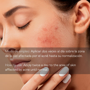 Valquer Serum facial antiacne directo - 30 ml