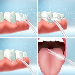 Irrigador Dental Recargable Portátil Denter InnovaGoods