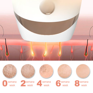 DAM T20 Depiladora IPL de luz pulsada. 5 niveles de intensidad. Display digital. 7x4x20 Cm. Color: Blanco