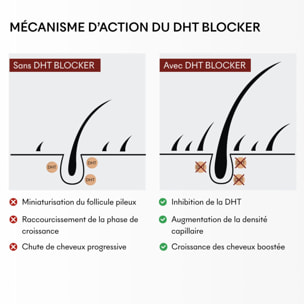 DHT Blocker - Complement Alimentaire Anti-Chute Hormonale 3 Mois