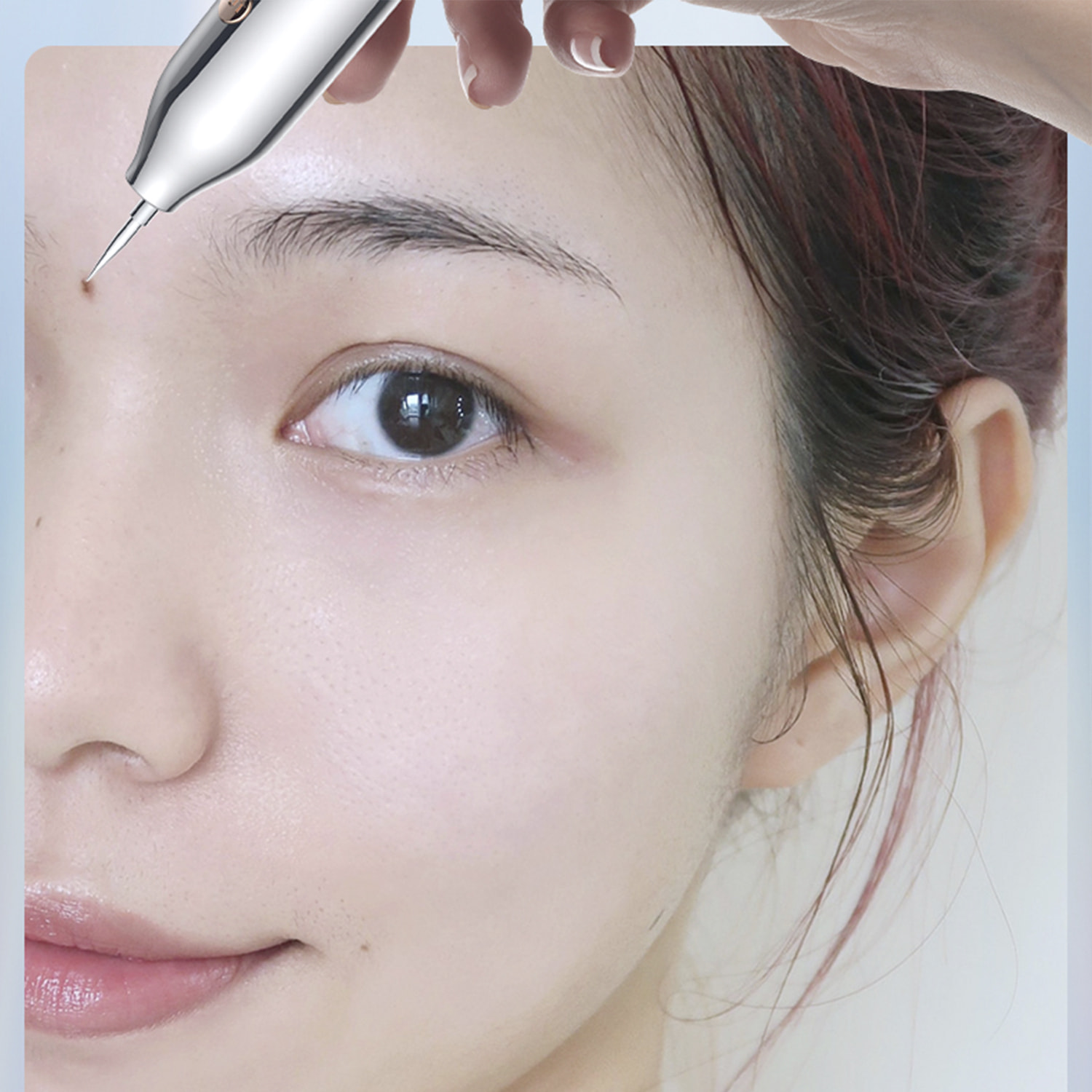 Bolígrafo para nevus. Para pecas, placas seniles, nevos planos, etc.