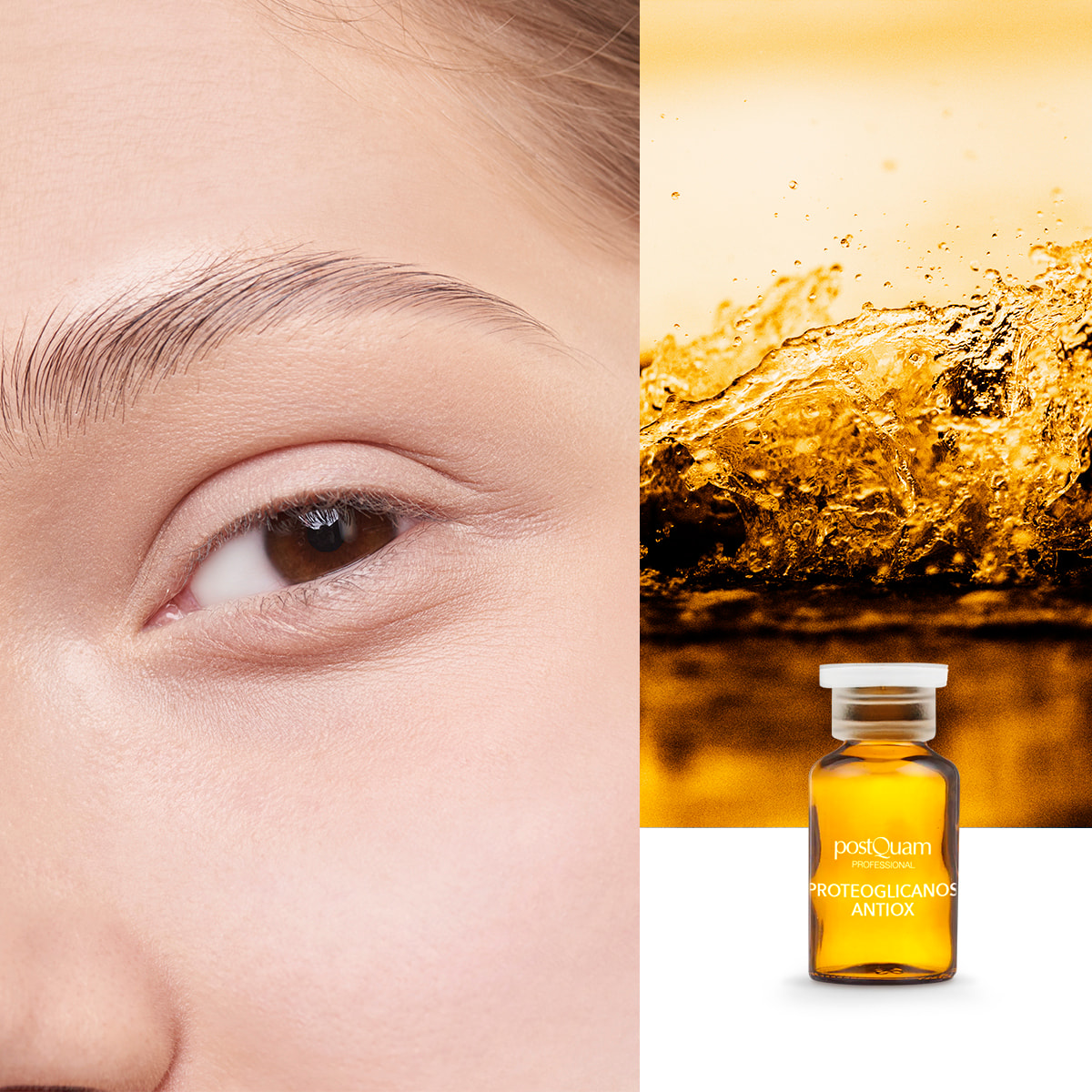 proteoglicanos antiox postquam